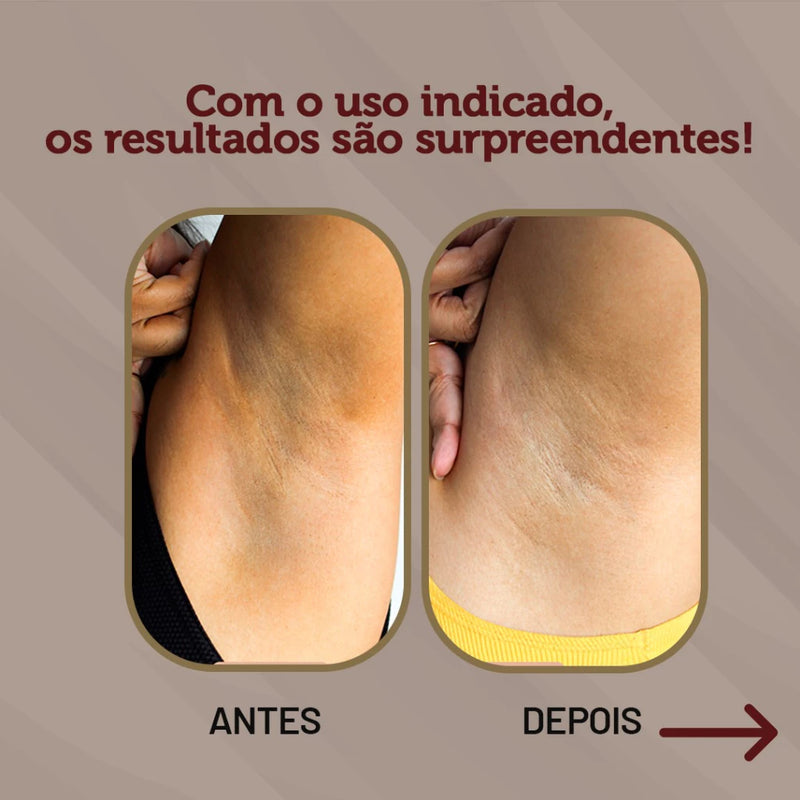 Kit Bumbum lisinho + Creme Clareador de Virilha e Axila